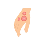 Dermatitis Solutions